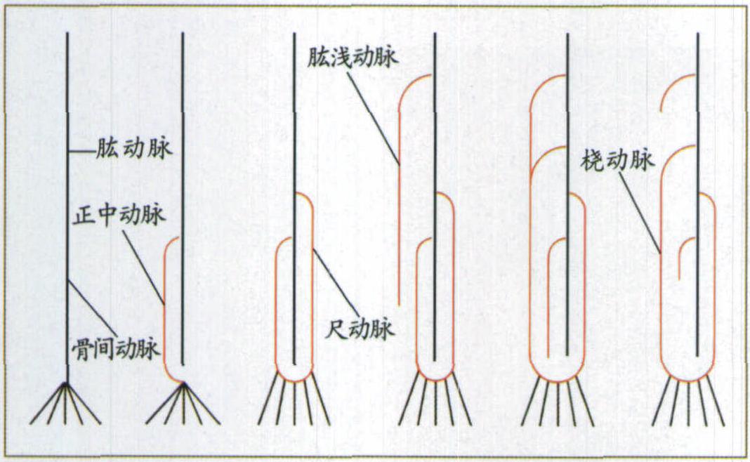 圖1-22 上肢動(dòng)脈的發(fā)生過(guò)程